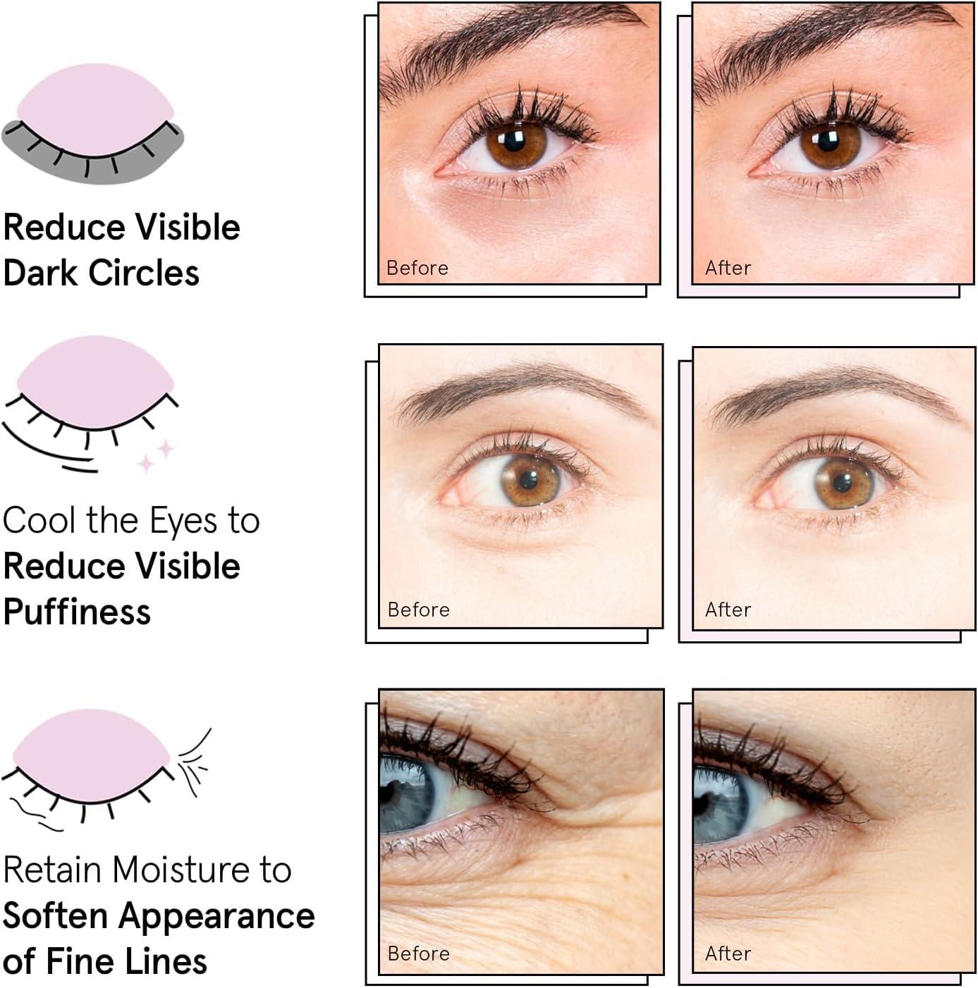imagegrace ampamp stella Award Winning Under Eye Mask Early Christmas Gift Ideas Gifts for Women Undereye Patches for Dark Circles Puffiness Wrinkles Gold Eye Mask 48 Pairs Hyaluronic Acid Serum 17mlBlue 48 Pairs