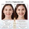 grace & stella Award Winning Hyaluronic Acid Serum (50ml/1.7 fl oz) Hydrating Hyaluronic Acid Serum for Face – Acido Hialuronico for Women – Remove Fine Lines, Wrinkles, Anti Aging – Vegan Skincare(Hyaluronic Acid Serum – 50ml Pump (Travel Size))