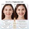 grace & stella Award Winning Hyaluronic Acid Serum (50ml/1.7 fl oz) Hydrating Hyaluronic Acid Serum for Face – Acido Hialuronico for Women – Remove Fine Lines, Wrinkles, Anti Aging – Vegan Skincare(Hyaluronic Acid Serum – 30ml Pump (Travel Size))