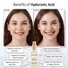 grace & stella Award Winning Hyaluronic Acid Serum (50ml/1.7 fl oz) Hydrating Hyaluronic Acid Serum for Face – Acido Hialuronico for Women – Remove Fine Lines, Wrinkles, Anti Aging – Vegan Skincare(Hyaluronic Acid Serum – 50ml Pump (Pack of 2))