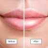 grace & stella Award Winning Lip Butter – Hydrating Lip Balm – Nourishing Lip Mask (1-pack) Travel Essentials, Travel Size Toiletries, Birthday Gifts for Women & Teens – Overnight Lip Repair – Vegan(Pack of 1)