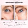grace & stella Eye Wrinkle Pads and Patches – Cooling Eye Mask for Puffiness – Ice Mask – Gel to Reduce Wrinkles, Dark Circles, Eyebags, Migraines – Hot & Cold(Eye Roller (15ml / 0.5Fl oz))