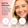 grace & stella Award Winning Pore Strip – Pimple Patches for Face – Hydrocolloid Acne Patches – Absorbs Zits, Reduces Redness – Cute Patches Dermatologist-Tested, Vegan (Multishape, 72 Count)(72 Count (Pack of 1))