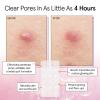 grace & stella Award Winning Pore Strip – Pimple Patches for Face – Hydrocolloid Acne Patches – Absorbs Zits, Reduces Redness – Cute Patches Dermatologist-Tested, Vegan (Multishape, 72 Count)(144 Count (Pack of 1))