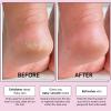 grace & stella Award-Winning Foot Peel Mask – Foot Peeling Mask with Aloe Vera – Moisturizing Foot Mask for Dry Cracked Feet – Foot Exfoliator for Baby Soft Feet (2 Pairs, Lavender)(Unscented with Aloe Vera  2 Pairs)